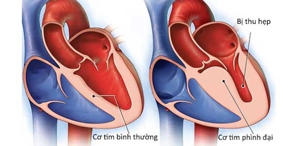 Cấu tạo của tim và những điều bạn cần biết về tim người